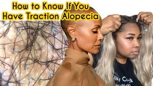 HAIR LOSS| How To Know if You Have Traction Alopecia